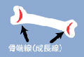骨端線